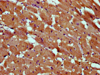 SKA2 Antibody - Immunohistochemistry Dilution at 1:400 and staining in paraffin-embedded human heart tissue performed on a Leica BondTM system. After dewaxing and hydration, antigen retrieval was mediated by high pressure in a citrate buffer (pH 6.0). Section was blocked with 10% normal Goat serum 30min at RT. Then primary antibody (1% BSA) was incubated at 4°C overnight. The primary is detected by a biotinylated Secondary antibody and visualized using an HRP conjugated SP system.