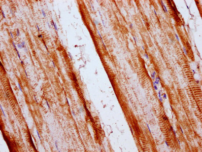 SKA2 Antibody - Immunohistochemistry Dilution at 1:400 and staining in paraffin-embedded human skeletal muscle tissue performed on a Leica BondTM system. After dewaxing and hydration, antigen retrieval was mediated by high pressure in a citrate buffer (pH 6.0). Section was blocked with 10% normal Goat serum 30min at RT. Then primary antibody (1% BSA) was incubated at 4°C overnight. The primary is detected by a biotinylated Secondary antibody and visualized using an HRP conjugated SP system.