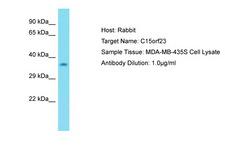 SKAP / HSD11 Antibody -  This image was taken for the unconjugated form of this product. Other forms have not been tested.