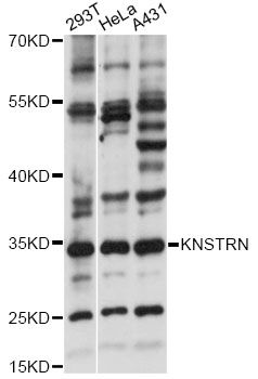 SKAP / HSD11 Antibody - Western blot analysis of extracts of various cell lines, using KNSTRN antibody at 1:1000 dilution. The secondary antibody used was an HRP Goat Anti-Rabbit IgG (H+L) at 1:10000 dilution. Lysates were loaded 25ug per lane and 3% nonfat dry milk in TBST was used for blocking. An ECL Kit was used for detection and the exposure time was 5s.