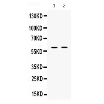 SKAP1 / SCAP1 Antibody - Western blot analysis of SKAP55 expression in PANC whole cell lysates (lane 1) and JURKAT whole cell lysates (lane 2). SKAP55 at 60 kD was detected using rabbit anti- SKAP55 Antigen Affinity purified polyclonal antibody at 0.5 ug/mL. The blot was developed using chemiluminescence (ECL) method.