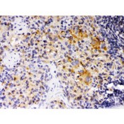SKAP1 / SCAP1 Antibody - SKAP55 was detected in paraffin-embedded sections of rat spleen tissues using rabbit anti- SKAP55 Antigen Affinity purified polyclonal antibody at 1 ug/mL. The immunohistochemical section was developed using SABC method.