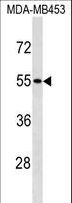 SKAP1 / SCAP1 Antibody - SKAP1 Antibody western blot of MDA-MB453 cell line lysates (35 ug/lane). The SKAP1 antibody detected the SKAP1 protein (arrow).
