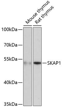 SKAP1 / SCAP1 Antibody - Western blot analysis of extracts of various cell lines using SKAP1 Polyclonal Antibody at dilution of 1:3000.