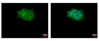 SKAP2 / SCAP2 Antibody - SCAP2 antibody [C2C3], C-term detects SKAP2 protein at cytoplasm by immunofluorescent analysis. HepG2 cells were fixed in 4% paraformaldehyde at RT for 15 min. SKAP2 protein stained by SCAP2 antibody [C2C3], C-term diluted at 1:500. 