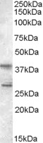 SKAP2 / SCAP2 Antibody - Antibody (0.5 ug/ml) staining of Jurkat lysate (35 ug protein in RIPA buffer). Primary incubation was 1 hour. Detected by chemiluminescence.