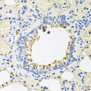 SKAP2 / SCAP2 Antibody - Immunohistochemistry of paraffin-embedded rat lung tissue.