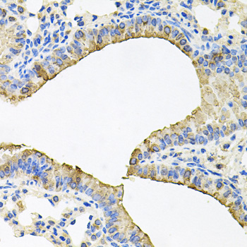 SKAP2 / SCAP2 Antibody - Immunohistochemistry of paraffin-embedded mouse lung tissue.