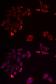 SKAP2 / SCAP2 Antibody - Immunofluorescence analysis of HeLa cells.