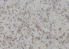 SKAP2 / SCAP2 Antibody - 1:100 staining human gastric tissue by IHC-P. The sample was formaldehyde fixed and a heat mediated antigen retrieval step in citrate buffer was performed. The sample was then blocked and incubated with the antibody for 1.5 hours at 22°C. An HRP conjugated goat anti-rabbit antibody was used as the secondary.