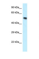 SKD1 / VPS4B Antibody - VPS4B antibody Western blot of 3 Cell lysate. Antibody concentration 1 ug/ml.  This image was taken for the unconjugated form of this product. Other forms have not been tested.