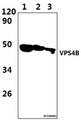 SKD1 / VPS4B Antibody - Western blot of VPS4B antibody at 1:1000 dilution. Lane 1: HEK293T whole cell lysate (57ug). Lane 2: The Lung tissue lysate of Rat (39ug). Lane 3: Raw264.7 whole cell lysate (51ug).