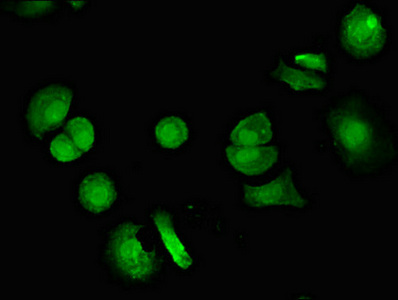 SKD1 / VPS4B Antibody - Immunofluorescent analysis of MCF-7 cells diluted at 1:100 and Alexa Fluor 488-congugated AffiniPure Goat Anti-Rabbit IgG(H+L)