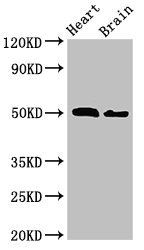 SKD1 / VPS4B Antibody - Western Blot Positive WB detected in:Mouse heart tissue,Mouse brain tissue All Lanes:VPS4B antibody at 2.5µg/ml Secondary Goat polyclonal to rabbit IgG at 1/50000 dilution Predicted band size: 50 KDa Observed band size: 50 KDa