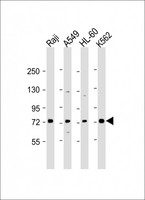 SKI Antibody - All lanes: Anti-SKI Antibody (N-Term) at 1:2000 dilution. Lane 1: Raji whole cell lysate. Lane 2: A549 whole cell lysate. Lane 3: HL-60 whole cell lysate. Lane 4: K562 whole cell lysate Lysates/proteins at 20 ug per lane. Secondary Goat Anti-Rabbit IgG, (H+L), Peroxidase conjugated at 1:10000 dilution. Predicted band size: 80 kDa. Blocking/Dilution buffer: 5% NFDM/TBST.