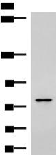 SKI Antibody - Western blot analysis of Raji cell lysate  using SKI Polyclonal Antibody at dilution of 1:800