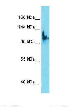 SKIDA1 / C10orf140 Antibody - Western blot of Human HepG2. SKIDA1 antibody dilution 1.0 ug/ml.  This image was taken for the unconjugated form of this product. Other forms have not been tested.