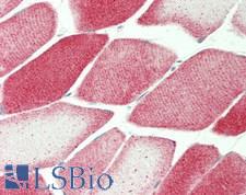 SKIL / SNO / SnoN Antibody - Human Skeletal Muscle: Formalin-Fixed, Paraffin-Embedded (FFPE)
