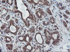 SKIL / SNO / SnoN Antibody - IHC of paraffin-embedded Human breast tissue using anti-SKIL mouse monoclonal antibody.