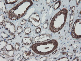 SKIL / SNO / SnoN Antibody - IHC of paraffin-embedded Human Kidney tissue using anti-SKIL mouse monoclonal antibody.