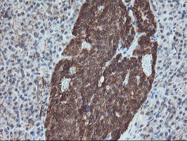 SKIL / SNO / SnoN Antibody - IHC of paraffin-embedded Human pancreas tissue using anti-SKIL mouse monoclonal antibody.