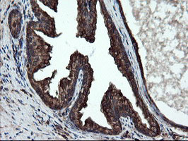 SKIL / SNO / SnoN Antibody - IHC of paraffin-embedded Human prostate tissue using anti-SKIL mouse monoclonal antibody.