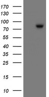 SKIL / SNO / SnoN Antibody - HEK293T cells were transfected with the pCMV6-ENTRY control (Left lane) or pCMV6-ENTRY SKIL (Right lane) cDNA for 48 hrs and lysed. Equivalent amounts of cell lysates (5 ug per lane) were separated by SDS-PAGE and immunoblotted with anti-SKIL.