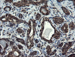 SKIL / SNO / SnoN Antibody - IHC of paraffin-embedded Human breast tissue using anti-SKIL mouse monoclonal antibody.