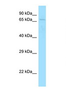 SKIL / SNO / SnoN Antibody - SKIL antibody Western blot of Mouse Spleen lysate. Antibody concentration 1 ug/ml.  This image was taken for the unconjugated form of this product. Other forms have not been tested.
