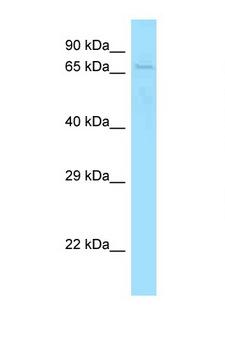 SKIL / SNO / SnoN Antibody - SKIL antibody Western blot of Mouse Spleen lysate. Antibody concentration 1 ug/ml.  This image was taken for the unconjugated form of this product. Other forms have not been tested.