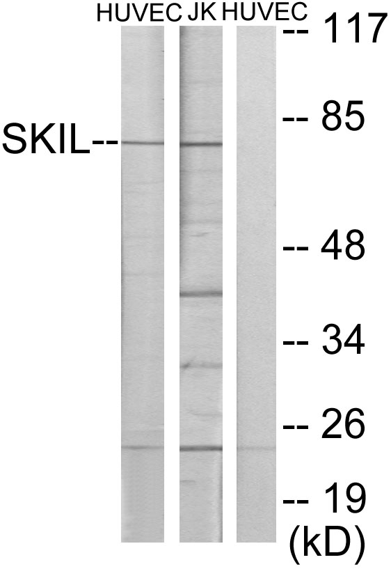SKIL / SNO / SnoN Antibody - Western blot analysis of lysates from HUVEC and Jurkat cells, using SKIL Antibody. The lane on the right is blocked with the synthesized peptide.