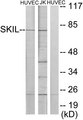 SKIL / SNO / SnoN Antibody - Western blot analysis of lysates from HUVEC and Jurkat cells, using SKIL Antibody. The lane on the right is blocked with the synthesized peptide.