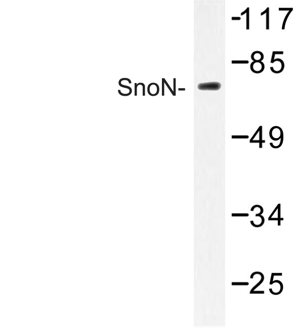 SKIL / SNO / SnoN Antibody - Western blot of SnoN (D652) pAb in extracts from HUVEC cells.
