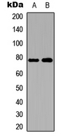 SKIL / SNO / SnoN Antibody - Western blot analysis of SKIL expression in A549 (A); Jurkat (B) whole cell lysates.