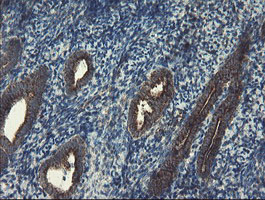 SKIL / SNO / SnoN Antibody - IHC of paraffin-embedded Human endometrium tissue using anti-SKIL mouse monoclonal antibody.