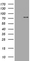 SKIL / SNO / SnoN Antibody - HEK293T cells were transfected with the pCMV6-ENTRY control (Left lane) or pCMV6-ENTRY SKIL (Right lane) cDNA for 48 hrs and lysed. Equivalent amounts of cell lysates (5 ug per lane) were separated by SDS-PAGE and immunoblotted with anti-SKIL.