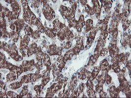 SKIL / SNO / SnoN Antibody - IHC of paraffin-embedded Human liver tissue using anti-SKIL mouse monoclonal antibody.