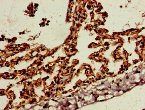 SKIL / SNO / SnoN Antibody - Immunohistochemistry of paraffin-embedded human lung tissue using SKIL Antibody at dilution of 1:100