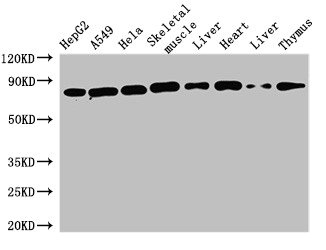 SKIL / SNO / SnoN Antibody - Western Blot Positive WB detected in: HepG2 whole cell lysate, A549 whole cell lysate, Hela whole cell lysate, Mouse skeletal muscle tissue, Mouse liver tissue, Rat heart tissue, Rat liver tissue, Rat thymus tissue All lanes: SKIL antibody at 1.6µg/ml Secondary Goat polyclonal to rabbit IgG at 1/50000 dilution Predicted band size: 77, 47, 72, 45, 75 kDa Observed band size: 77 kDa
