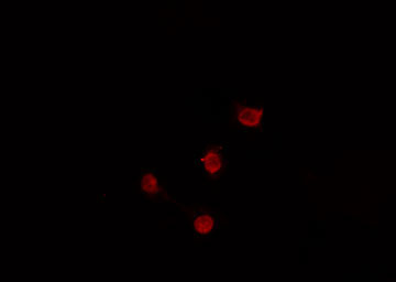 SKIL / SNO / SnoN Antibody - Staining HuvEc cells by IF/ICC. The samples were fixed with PFA and permeabilized in 0.1% Triton X-100, then blocked in 10% serum for 45 min at 25°C. The primary antibody was diluted at 1:200 and incubated with the sample for 1 hour at 37°C. An Alexa Fluor 594 conjugated goat anti-rabbit IgG (H+L) antibody, diluted at 1/600, was used as secondary antibody.