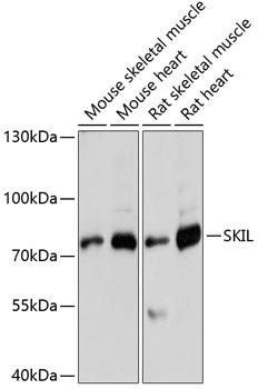 SKIL / SNO / SnoN Antibody - Western blot analysis of extracts of various cell lines using SKIL Polyclonal Antibody at dilution of 1:3000.