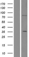 SKIL / SNO / SnoN Protein - Western validation with an anti-DDK antibody * L: Control HEK293 lysate R: Over-expression lysate