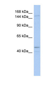 SKIV2L / SKI2 Antibody - SKIV2L antibody Western blot of COLO205 cell lysate. This image was taken for the unconjugated form of this product. Other forms have not been tested.