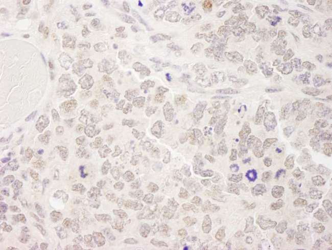 SKIV2L2 Antibody - Detection of Mouse SKIV2L2 by Immunohistochemistry. Sample: FFPE section of mouse teratoma. Antibody: Affinity purified rabbit anti-SKIV2L2 used at a dilution of 1:250. Epitope Retrieval Buffer-High pH (IHC-101J) was substituted for Epitope Retrieval Buffer-Reduced pH.