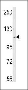 SKIV2L2 Antibody - Western blot of SKIV2L2 Antibody in MCF-7 cell line lysates (35 ug/lane). SKIV2L2 (arrow) was detected using the purified antibody.