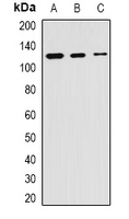 SKIV2L2 Antibody - Western blot analysis of SKIV2L2 expression in HeLa (A); mouse kidney (B); mouse testis (C) whole cell lysates.