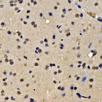 SKIV2L2 Antibody - Immunohistochemical analysis of SKIV2L2 staining in rat brain formalin fixed paraffin embedded tissue section. The section was pre-treated using heat mediated antigen retrieval with sodium citrate buffer (pH 6.0). The section was then incubated with the antibody at room temperature and detected using an HRP conjugated compact polymer system. DAB was used as the chromogen. The section was then counterstained with hematoxylin and mounted with DPX.