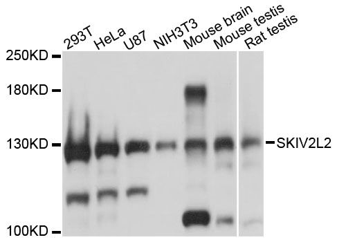 SKIV2L2 Antibody - Western blot analysis of extracts of various cell lines, using SKIV2L2 antibody at 1:3000 dilution. The secondary antibody used was an HRP Goat Anti-Rabbit IgG (H+L) at 1:10000 dilution. Lysates were loaded 25ug per lane and 3% nonfat dry milk in TBST was used for blocking. An ECL Kit was used for detection and the exposure time was 1s.