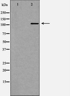 SKIV2L2 Antibody - Western blot analysis of HeLa whole cells lysates using MTR4 antibody. The lane on the left is treated with the antigen-specific peptide.