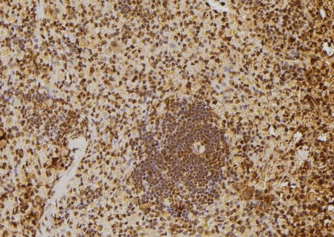 SKIV2L2 Antibody - 1:100 staining rat spleen tissue by IHC-P. The sample was formaldehyde fixed and a heat mediated antigen retrieval step in citrate buffer was performed. The sample was then blocked and incubated with the antibody for 1.5 hours at 22°C. An HRP conjugated goat anti-rabbit antibody was used as the secondary.
